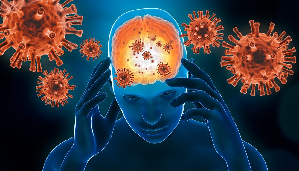Encephalitis: Causes, Symptoms, Treatment