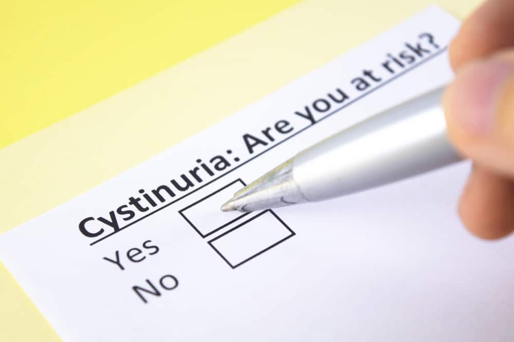 Cystinuria: Causes, Symptoms, Treatment