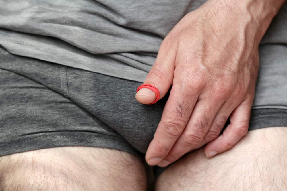 When the Foreskin Gets Stuck: Paraphimosis and How To Treat It