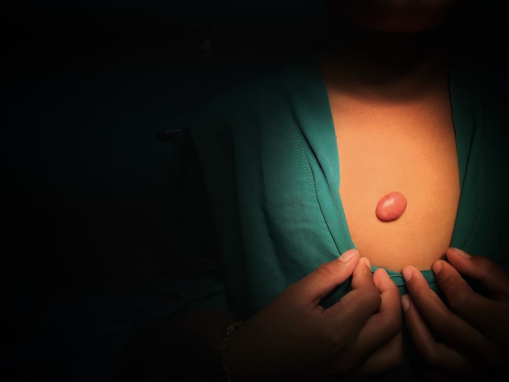 13 Types of Cysts: Symptoms and Causes