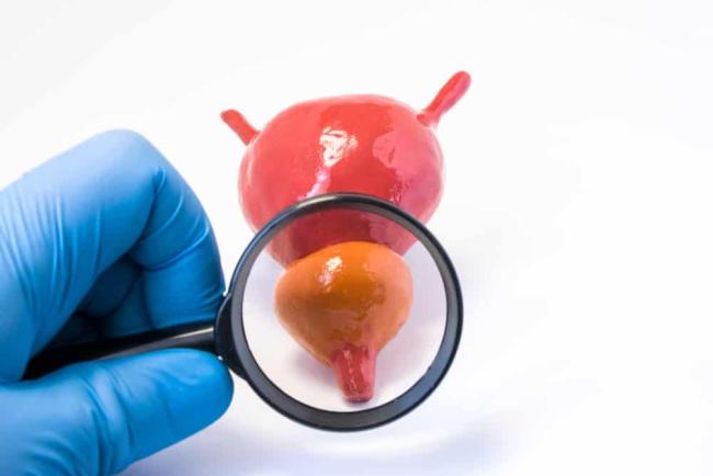 BPH and Other Common Prostate Problems