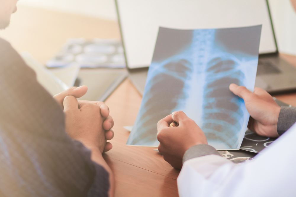 Pulmonya Dahil Sa Coronavirus: Paano Ito Nangyayari?