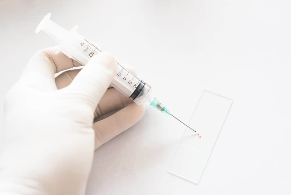 Ano ang FNAC test, at kailan ito kinakailangan?