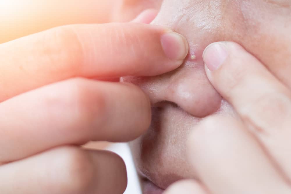 Tigyawat: To Pop or Not To Pop?