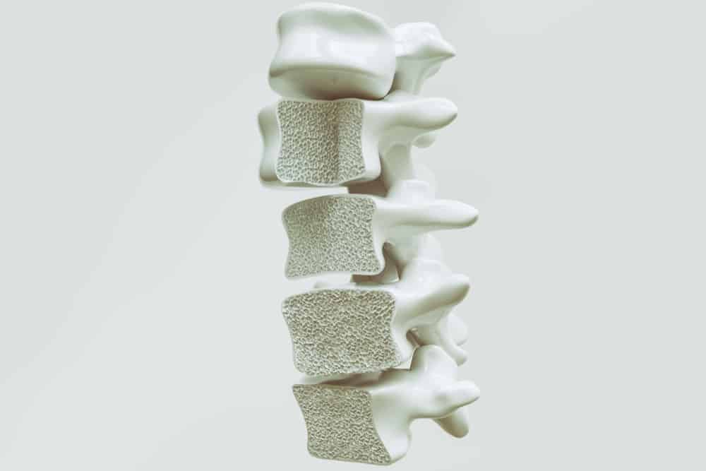 Senile Osteoporosis: Symptoms, Causes, Treatment, and Prevention