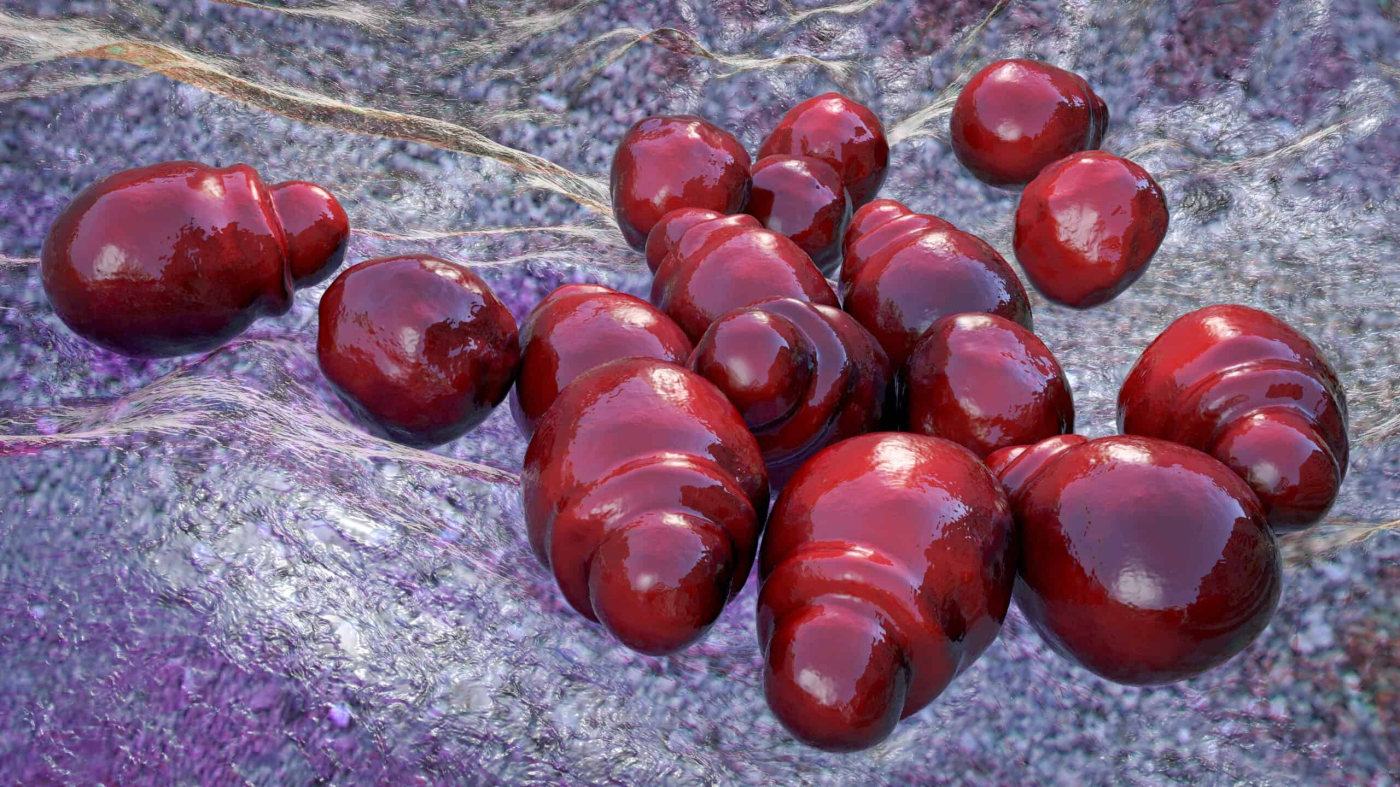 Malassezia Yeast Na Sanhi Ng Fungal Infections, Paano Nga Ba Gamutin?