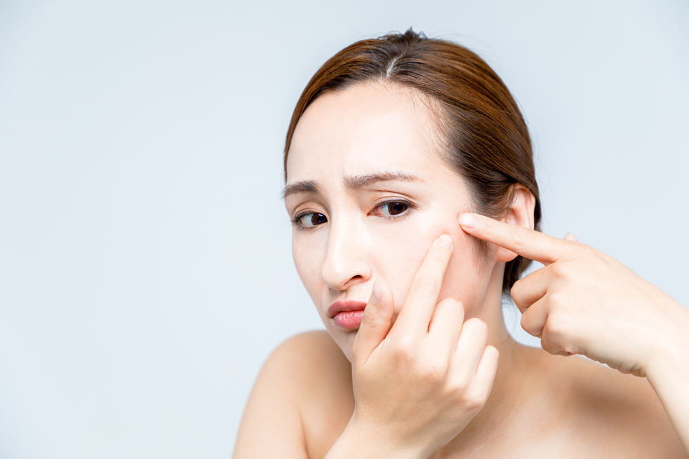 How to Cure Boils at Home: 5 Things You Need to Remember