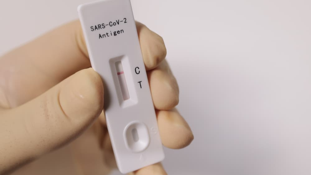 Buying Rapid Antigen Test Kits Online? Consider These Things First