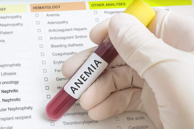 Anemia and COVID-19: What's the Connection?