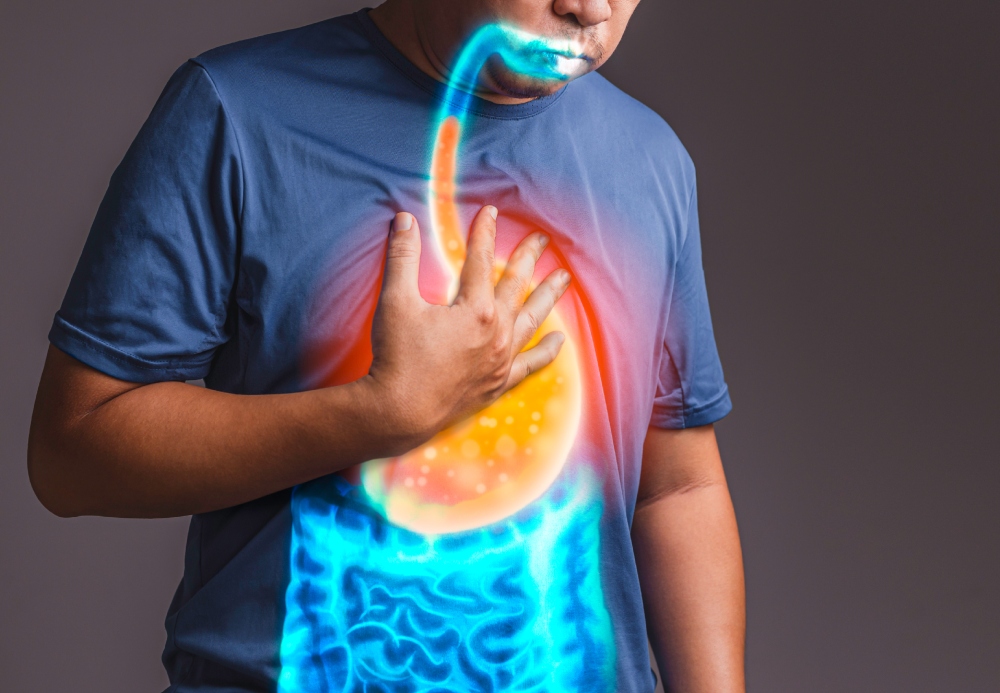 Heartburn: Sintomas, Sanhi, at Paraan sa Paggamot