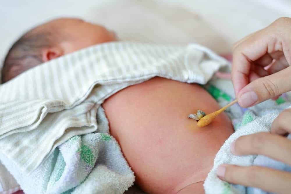 Pusod Ng Baby: Paano Ang Tamang Pag-Aalaga Dito?