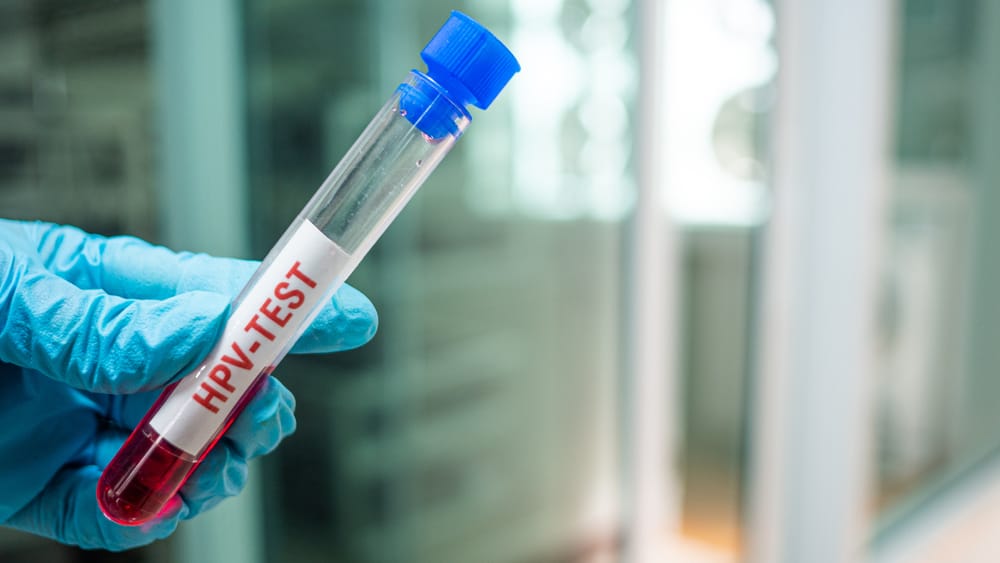 Sintomas Ng HPV: Mabilis Bang Lumabas Ang Mga Ito?