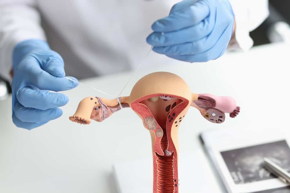 Tubal Ligation Reversal: What You Need to Know