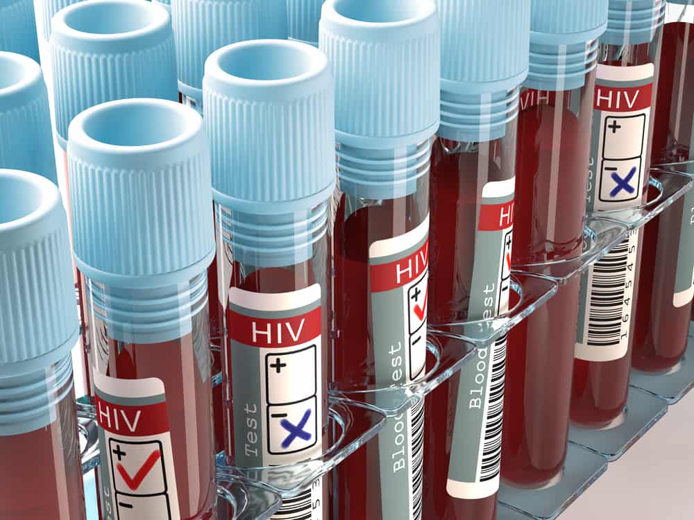 HIV test sa Pilipinas: Saan nakakakuha, at paano ito ginagawa?