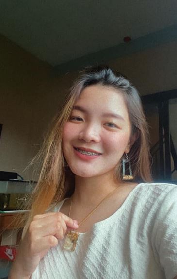 Sintomas ng aneurysm sa utak, anu-ano ito? Alamin dito!