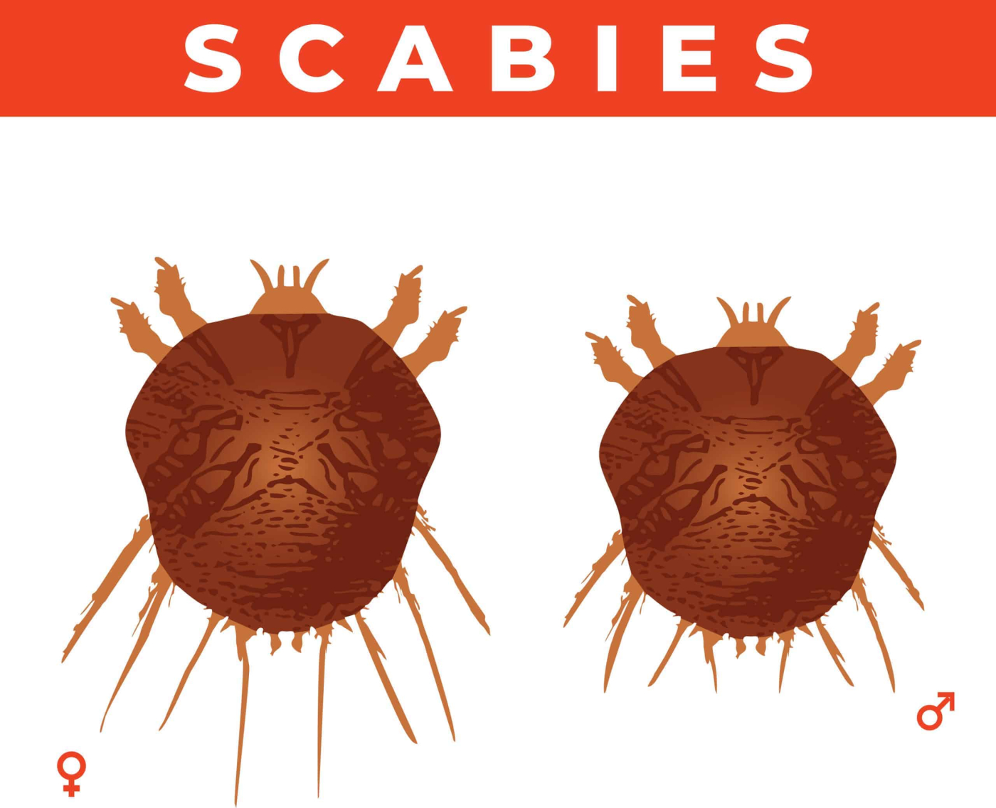 Mag-ingat Sa Pangangati Ng Balat: Paano Matutukoy Ang Mga Scabies?