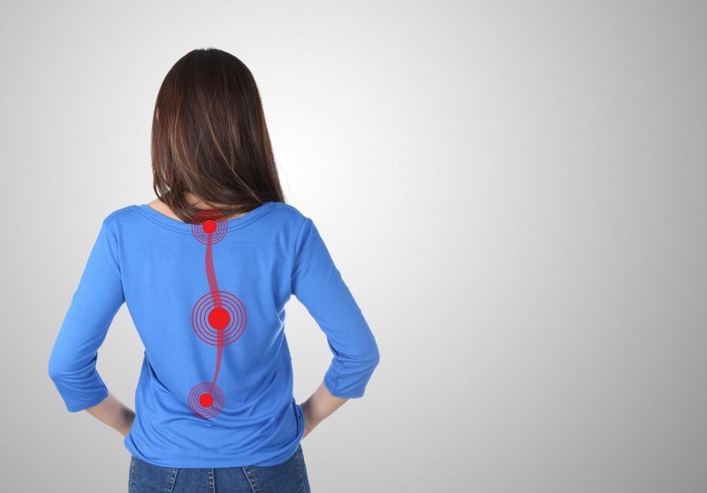 Ehersisyo Para sa Scoliosis, Paano Nakatutulong sa Kondisyong Ito?