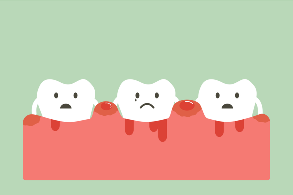 What Conditions Cause Swollen Gums?