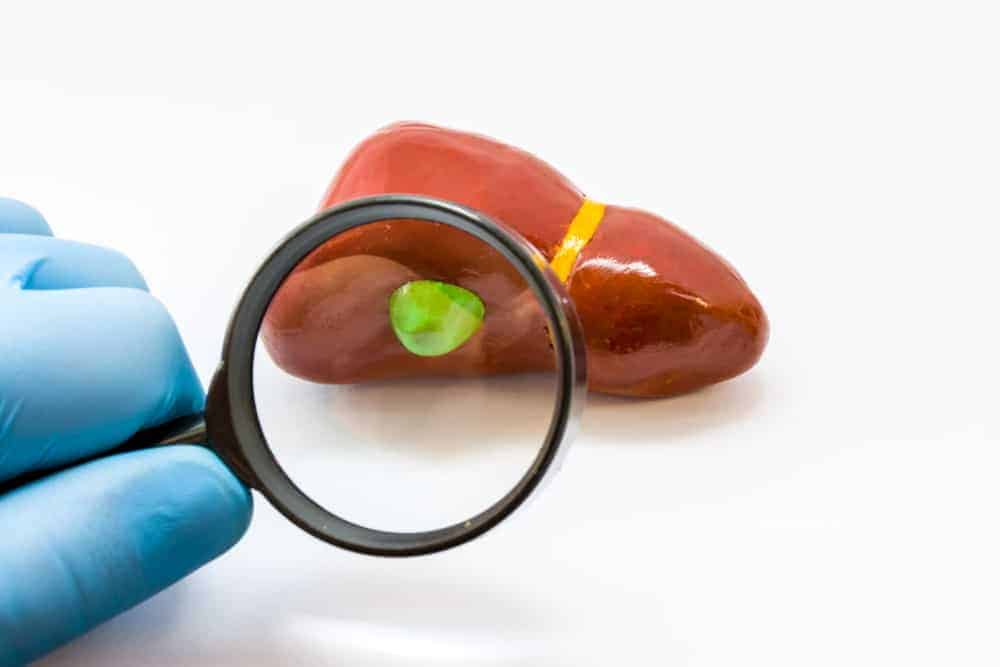 Sakit Sa Gallbadder: Ano Ang Ibig Sabihin Ng "Contracted Gallbladder?"