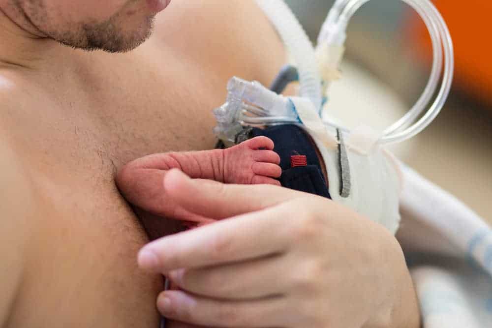 Benepisyo ng Kangaroo Care sa Bata, Alamin Dito