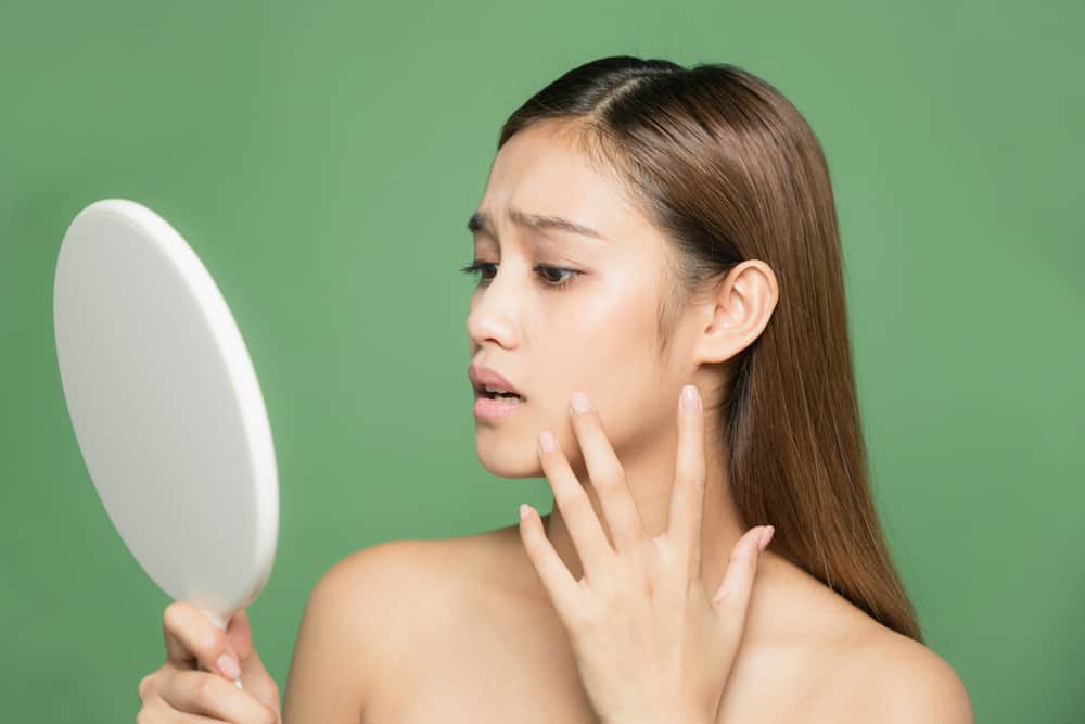 Paglabas Ng Mga Tigyawat O Acne Breakouts: Ano Ang Dapat Gawin?
