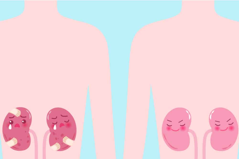 Karaniwang Sakit sa Bato: Anu-ano ang mga Ito?