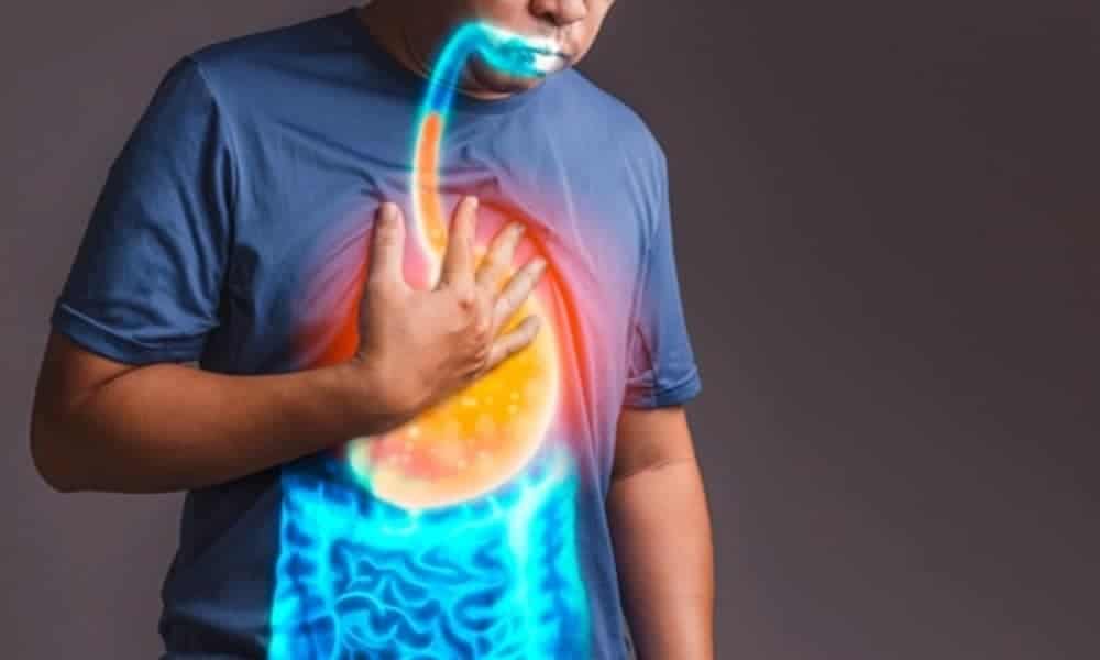Pinagkaiba ng Acid Reflux at Heartburn, Ano nga ba?