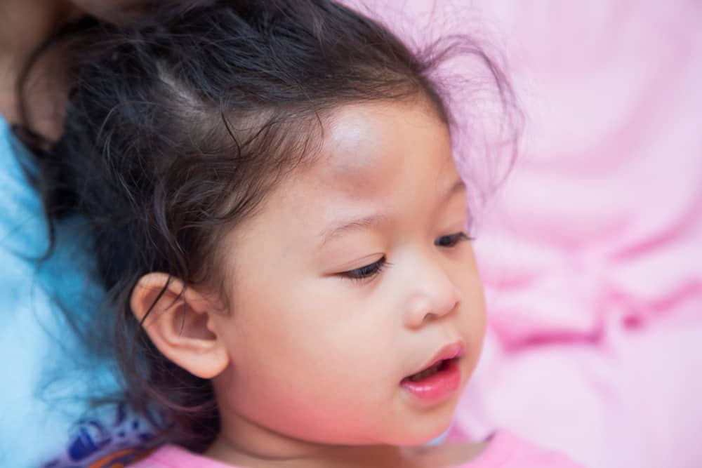 Bukol Ng Bata: Dapat Bang Ipag-Alala Ang Bukol Sa Katawan?