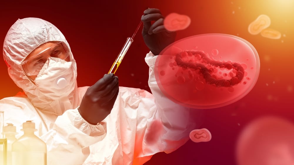 First Case Of Monkeypox Sa Pilipinas, Ikinumpirma Ng DOH