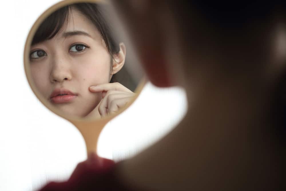 Bakit Nagkakaroon Ng Batik Batik Na Puti Sa Balat? Alamin Dito