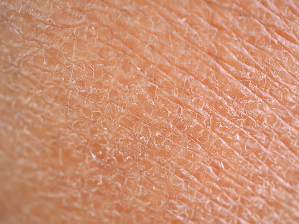 Magaspang Na Balat, Bakit At Paano Nagkakaroon Nito?