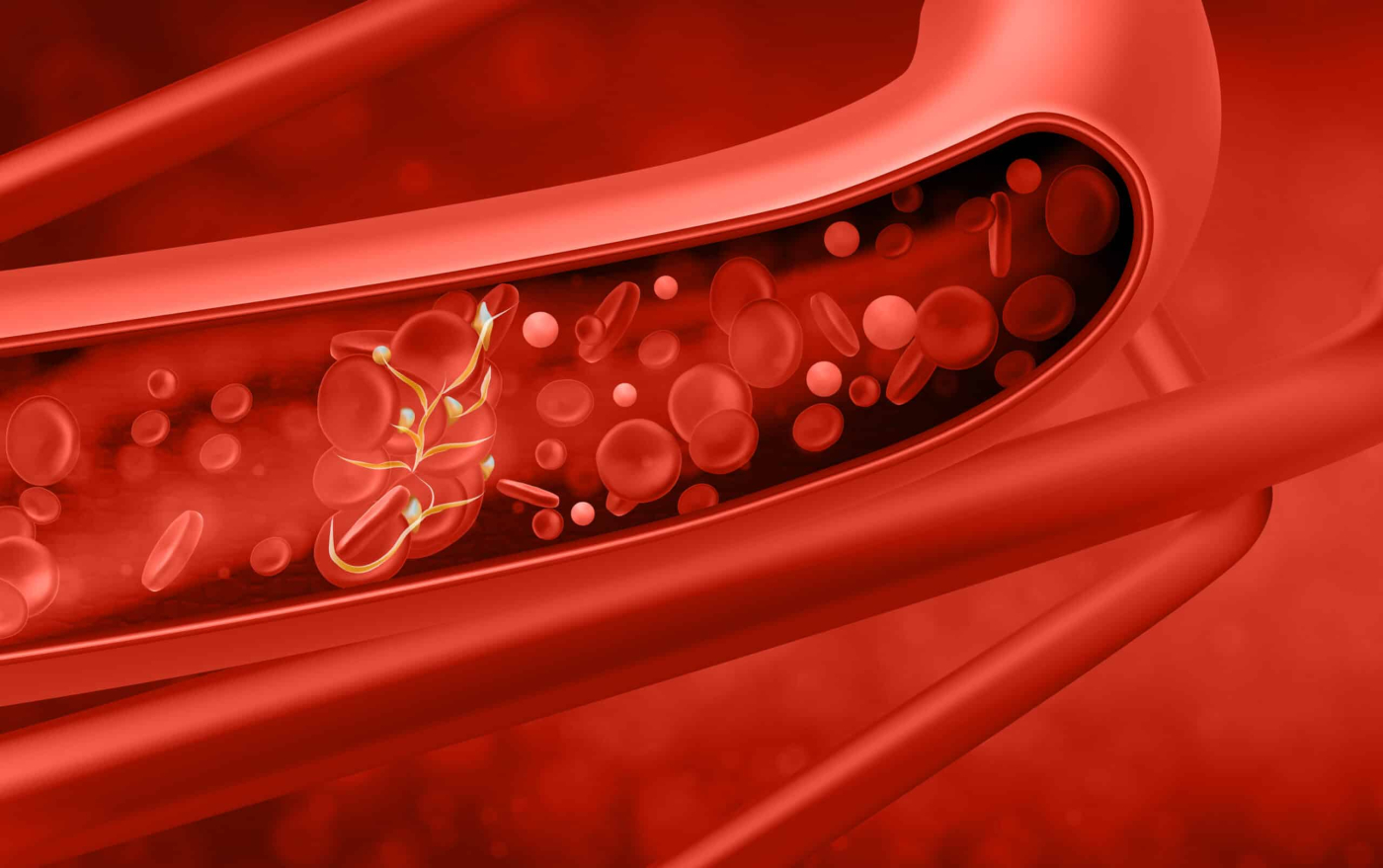 What’s The Difference: Arteries, Veins, and Capillaries?