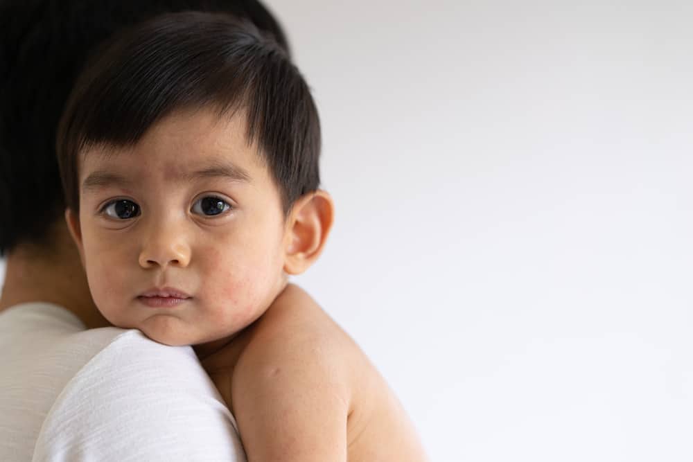 ano-ang-german-measles