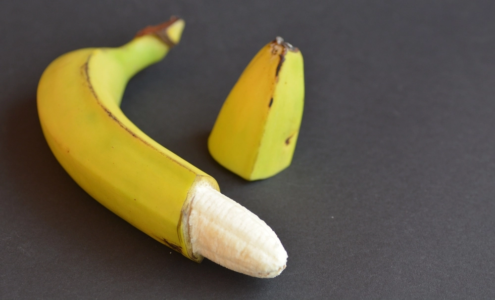 Pearly Penile Papules: Bakit Nagkakaroon ng Butlig-butlig sa Ari ng Lalaki