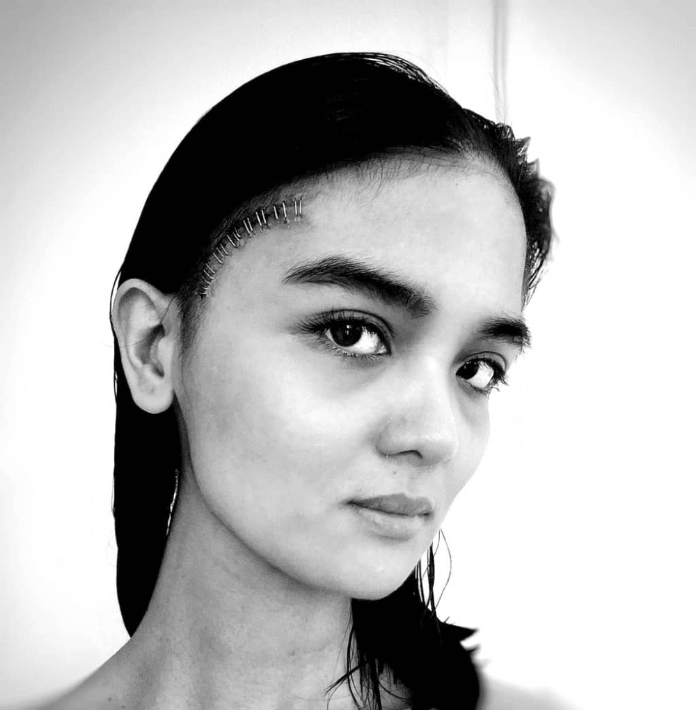 Basahin: Brain Aneurysm Survivor Sa Edad Na 37, Pia Lizares