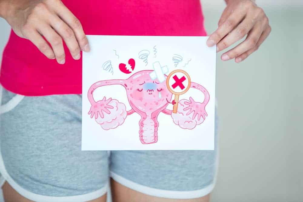 Alamin: Ano Nga Ba Ang Sanhi Ng Ovarian Cancer?