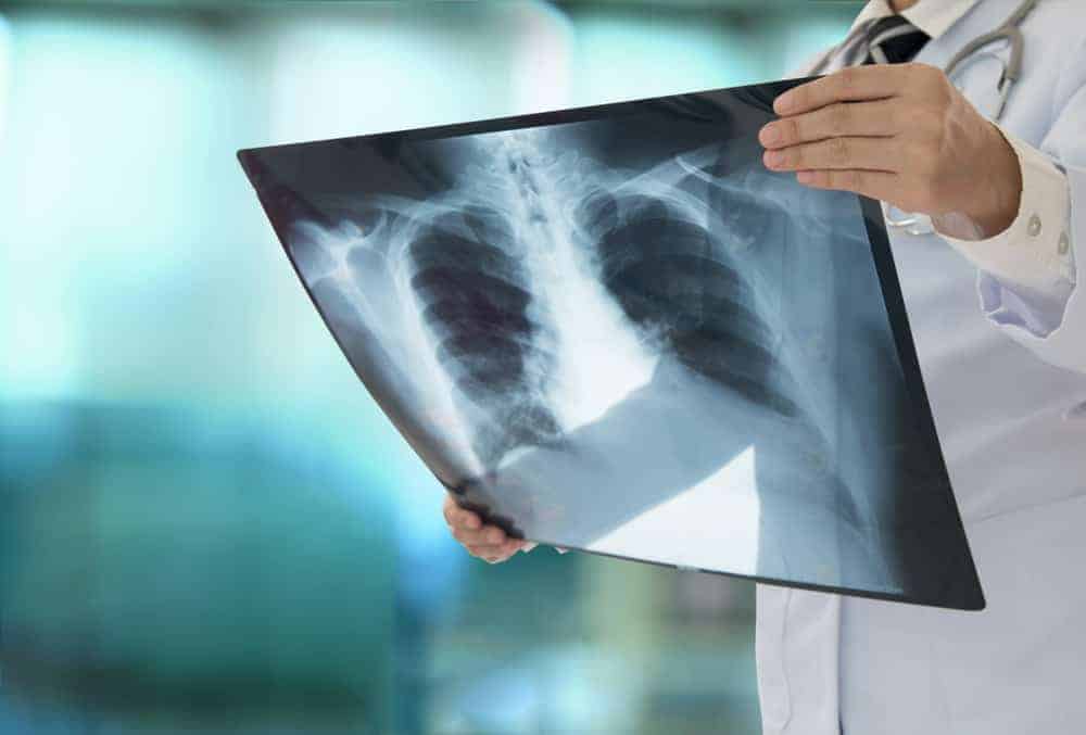 Ano ang Pinagkaiba ng Pneumonia sa Tuberculosis?