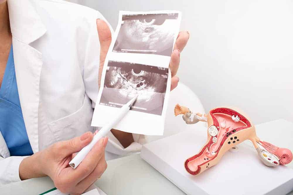Ano ang ginagawa sa ultrasound para sa ovarian cancer?