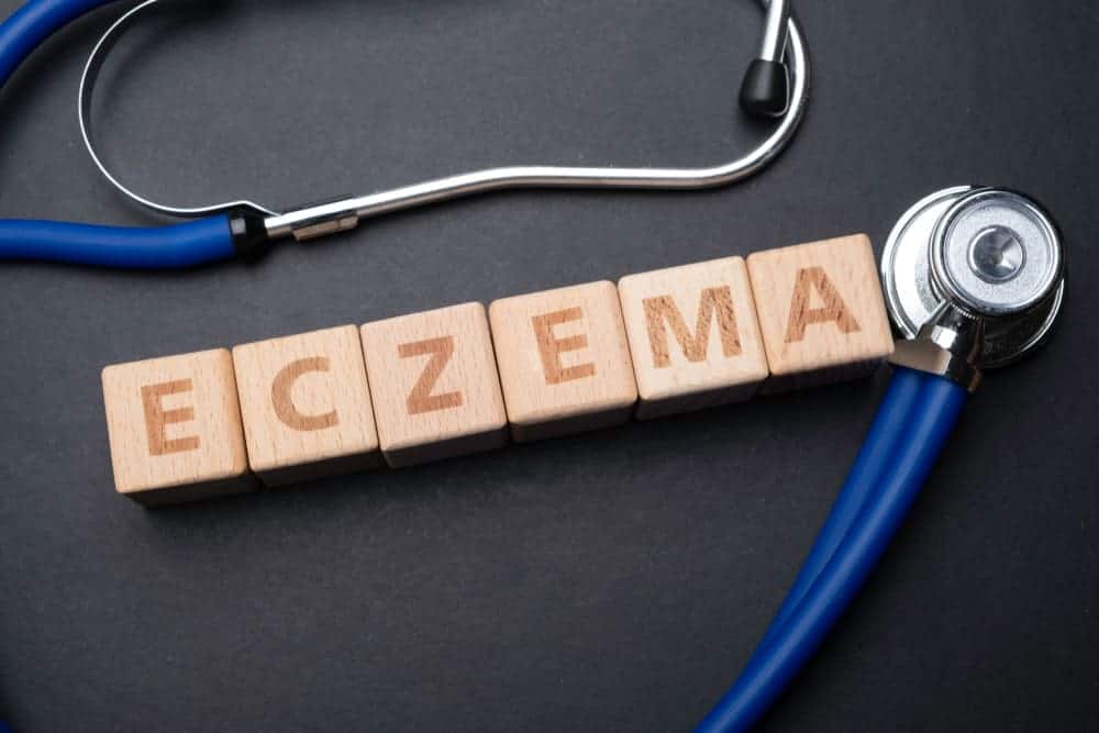 Long Term Prognosis sa Eczema: Epekto at Pamamahala