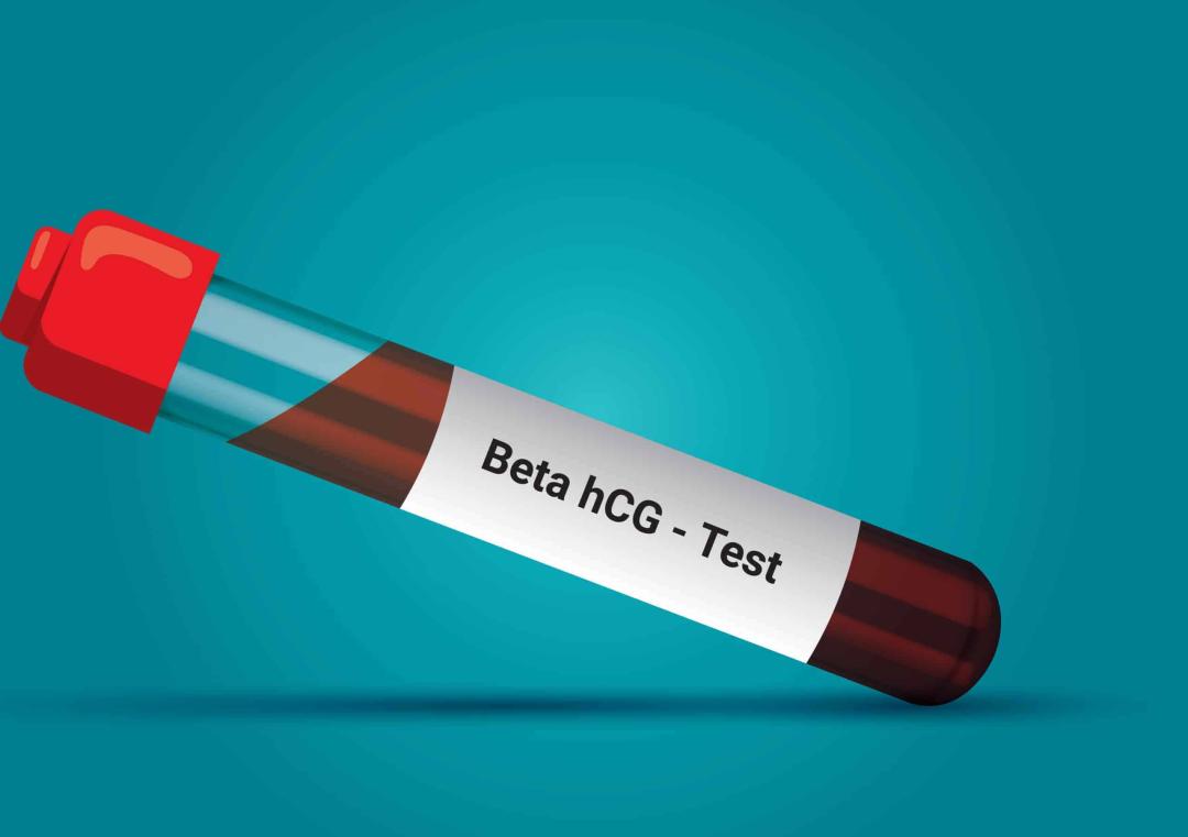 Ano ang Beta HCG Test at Paano Ito Ginagawa?