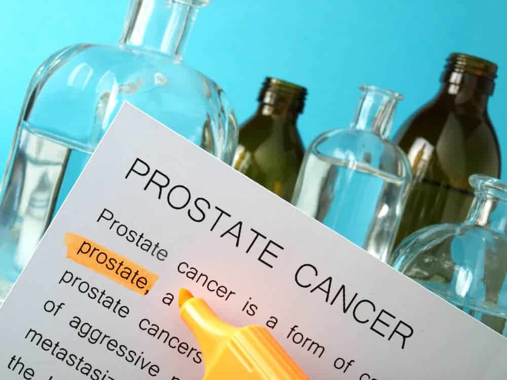 Alamin Dito Kung Ano Ang Puwedeng Gamot Para Sa Prostate Cancer