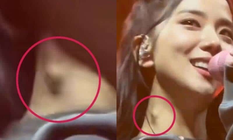 YG Entertainment, Nilinaw Ang Isyu Ng Bukol Sa Leeg Ni Jisoo!
