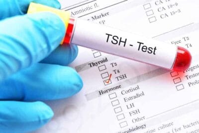 Thyroid-Stimulating Hormone Test: Bakit At Paano Ito Ginagawa?