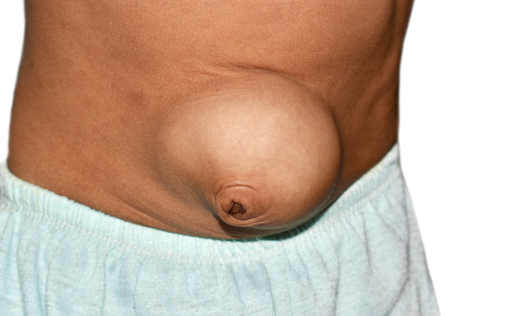 Ano Ang Luslos, At Paano Ito Pwedeng Magamot?