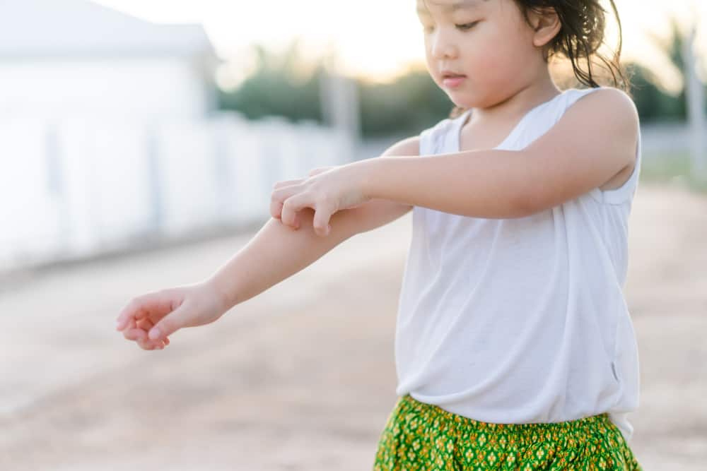 3 Dahilan Ng Pangangati Ng Bata, Ayon Sa Mga Doktor At Eksperto!
