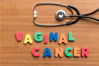 Kaalaman Tungkol sa Vaginal Cancer: Mga Sanhi, Sintomas, at Gamutan