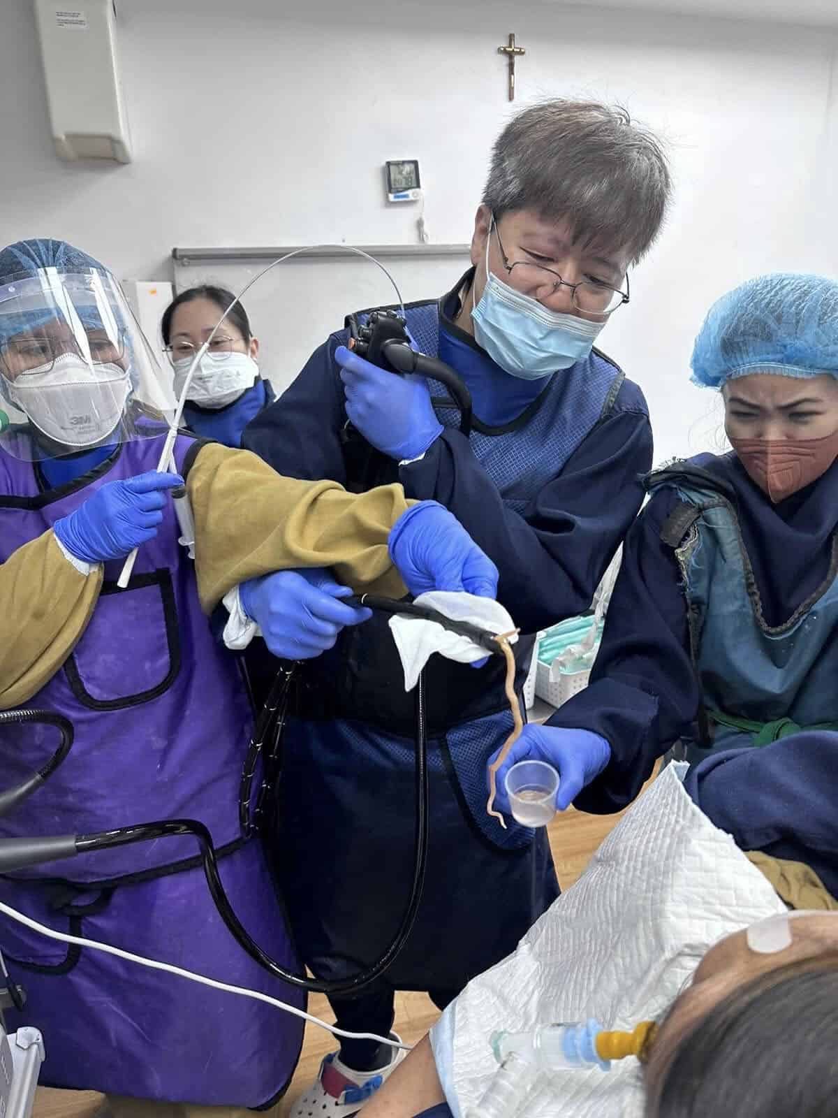 Buhay Na Bulate, Paano Tinanggal Mula Sa Bibig Ng Pasyente?