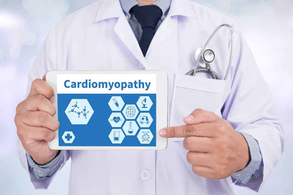 Paano Malalaman Ang Mga Sintomas Ng Cardiomyopathy Ayon Sa Uri Nito?