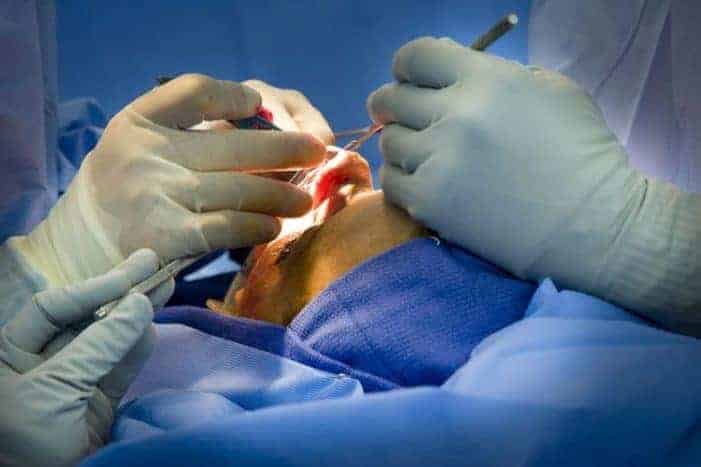 Paano Ginagawa ang Rhinoplasty At Para Saan Ito?