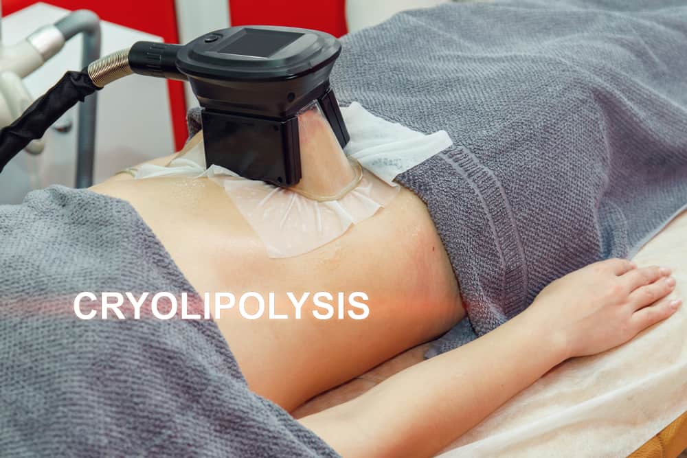 Ano Ang Coolsculpting At Ligtas Ba Ito?